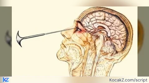 Universal Lobotomy Script - Verified script for Universal Script